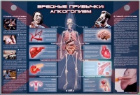 Электрифицированный стенд "Вредные привычки: алкоголизм" - «globural.ru» - Пенза