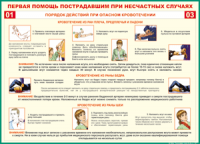 Таблица Порядок действий при опасном кровотечении 1000*1400 винил - «globural.ru» - Пенза